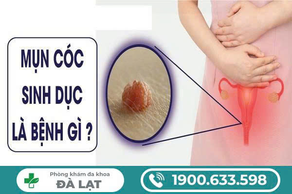 Hình ảnh minh họa